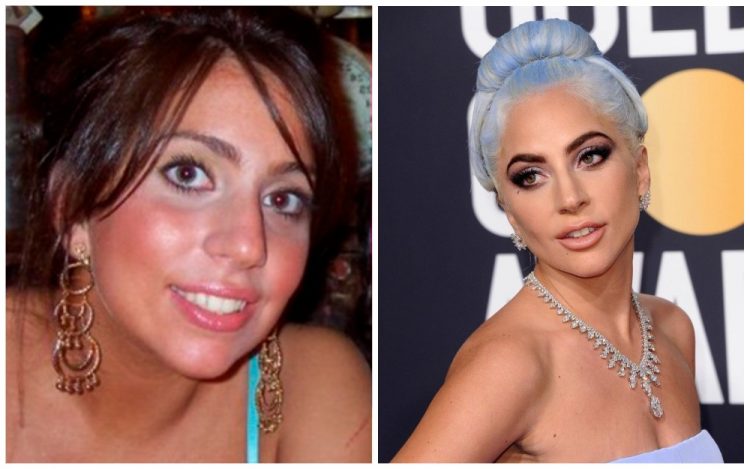 Celebs Before And After Fame: Impressive Pics