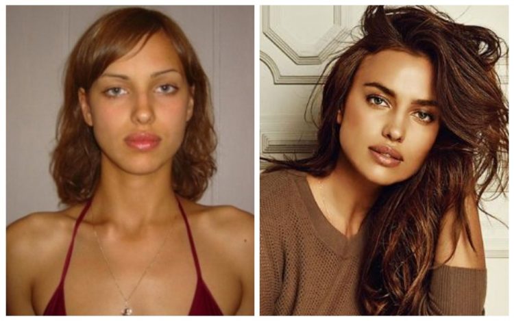 Celebs Before And After Fame: Impressive Pics