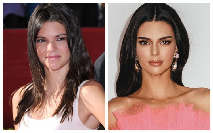 Celebs Before And After Fame: Impressive Pics