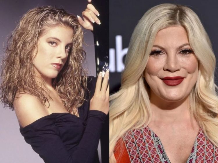 Celebrities After Failed Plastic Surgery